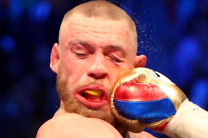 Así quedó el rostro de McGregor, el perdedor