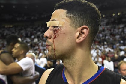 Así quedó la cara de Austin Rivers