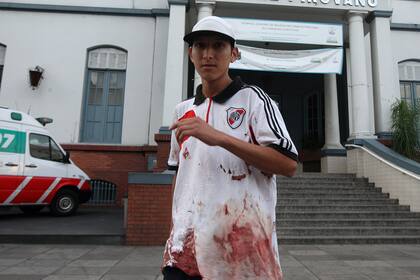 Así quedó la ensangrentada camiseta de uno de los heridos