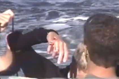 Así quedó la mano del surfista luego de sufrir el ataque de un tiburón