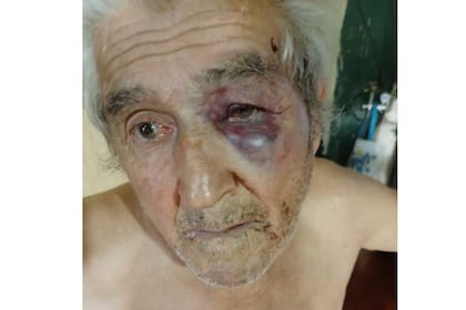 Así quedó la víctima tras los golpes del vecino