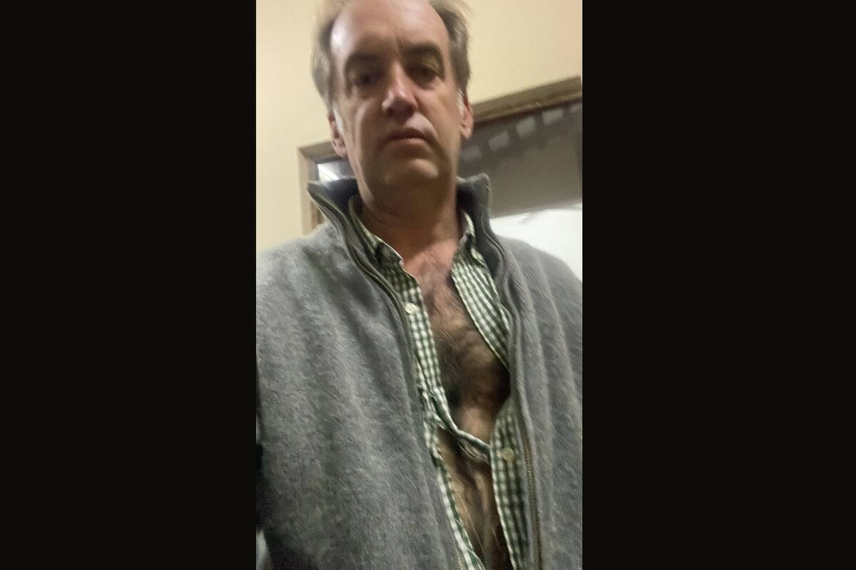 Así quedó Lucas Norris, el productor salteño, luego de ser golpeado por camioneros