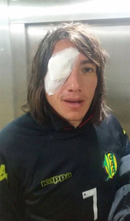 Así quedó Lugüercio tras la agresión