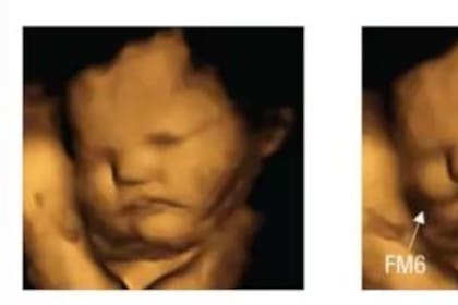 Así reaccionó este feto 20 minutos después de que su mamá comiera una capsula de zanahoria en polvo