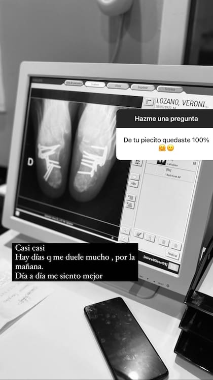Así se encuentran los pies de Vero Lozano con clavos
