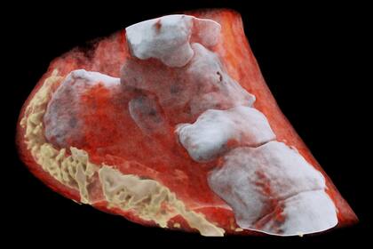 Así se ve una radiografía 3D a color con la nueva tecnología desarrollada por la empresa neozelandesa Mars Bioimaging