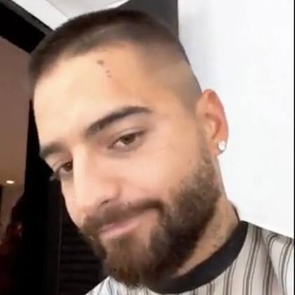 Así se veía el rostro del cantante