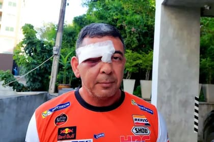 Así terminó Gary Reed luego de la agresión y la atención en el hospital