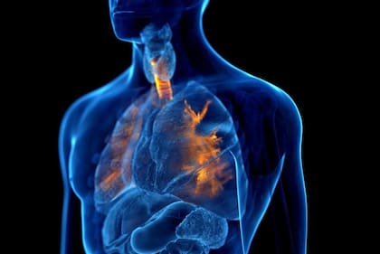Los ataques de asma suelen desencadenarse por un factor externo, como el aire frío o un alergeno