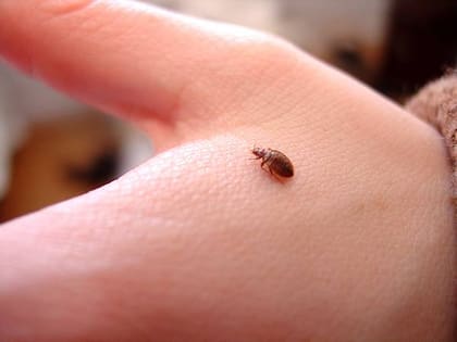 Aunque estas mordeduras no suelen ser peligrosas para la salud, es importante tratar los síntomas y, más aún, prevenir una posible infestación (Imagen ilustrativa)