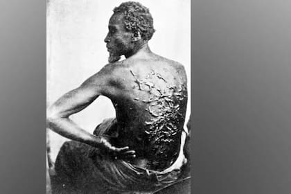 Aunque su piel había sido desgarrada numerosas veces por los latigazos y había cicatrizado, Gordon, un hombre esclavizado que había logrado escapar, posó desafiante para un retrato en 1863