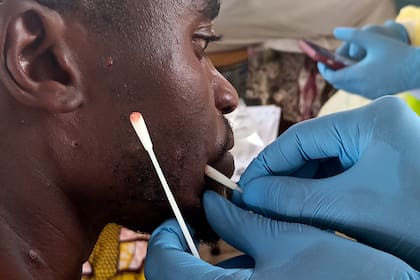 Avance de rebeldes respaldados por Ruanda complica la respuesta al mpox en el Congo