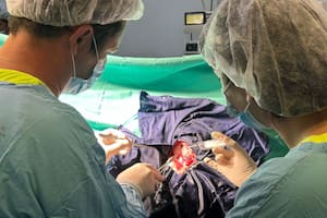 Awake Surgery, la técnica para remover tumores cerebrales con el paciente despierto