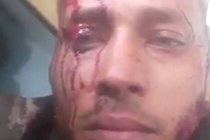 Ayer, en un operativo de la policía chavista, el grupo de Pérez fue acorralado