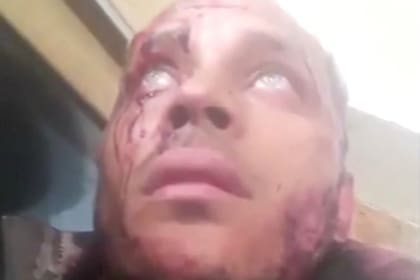 Ayer la Alta Comisionada de las Naciones Unidas para los Derechos Humanos presentó el informe oral sobre Venezuela y expresó su preocupación por el impacto de la crisis