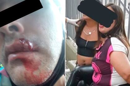 Ayer por la noche, un policía terminó herido luego de solicitar a dos mujeres que utilizaran barbijo; las mujeres, después de la agresión, fueron detenidas