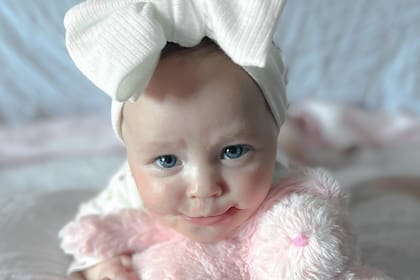 Ayla, la pequeña con Síndrome de la sonrisa permanente que se volvió una influencer en las redes para difundir su trastorno