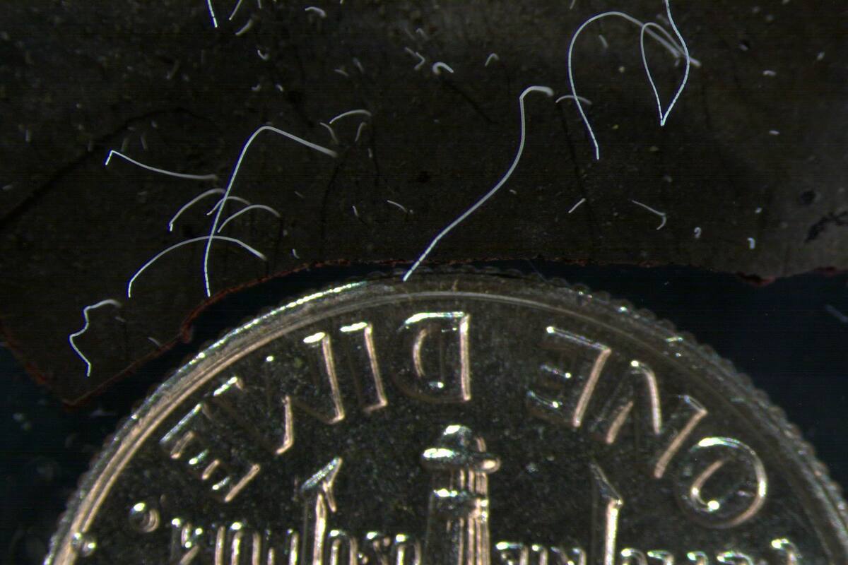 Bacterias de la especie 'Thiomargarita magnifica', con una moneda de 10 centavos de dólar