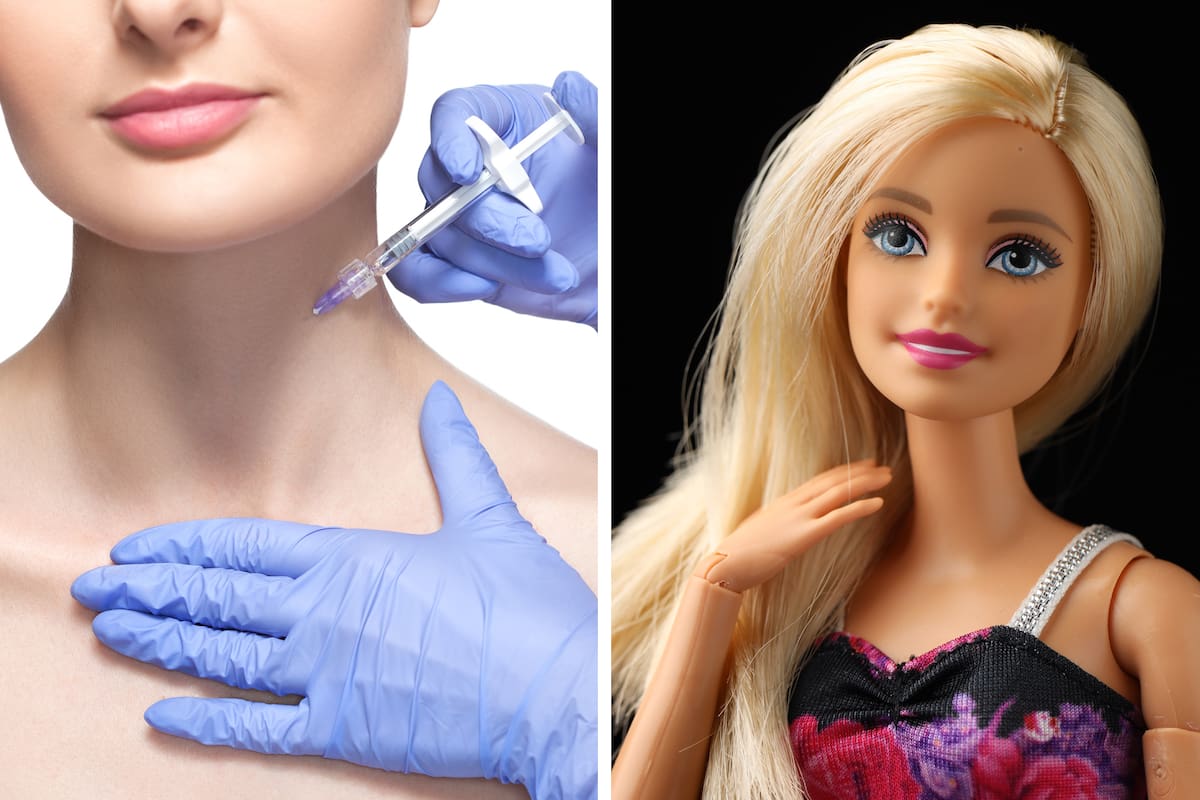 Barbie Botox: en TikTok se puede encontrar videos vinculados a los fines de salud y disminución del dolor del trap tox como también testimonios en primera persona de quienes alegan someterse a este tratamiento para lucir como la icónica muñeca