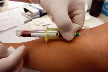 Los pacientes mostraron un marcado incremento de las transaminasas, aspartato y alanina por encima de 500