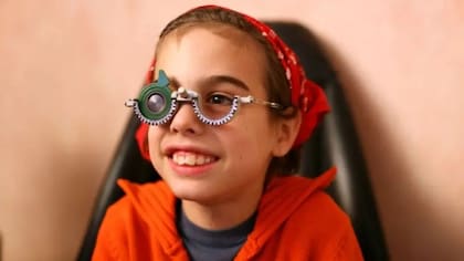 Bate cree que puede haber algún vínculo entre los problemas de visión en la infancia y las dificultades para reconocer rostros