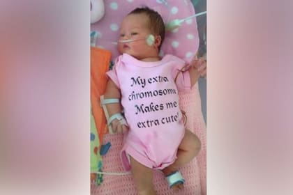 A Jaimie le diagnosticaron síndrome de Down al nacer, pero no tiene otras complicaciones de salud.