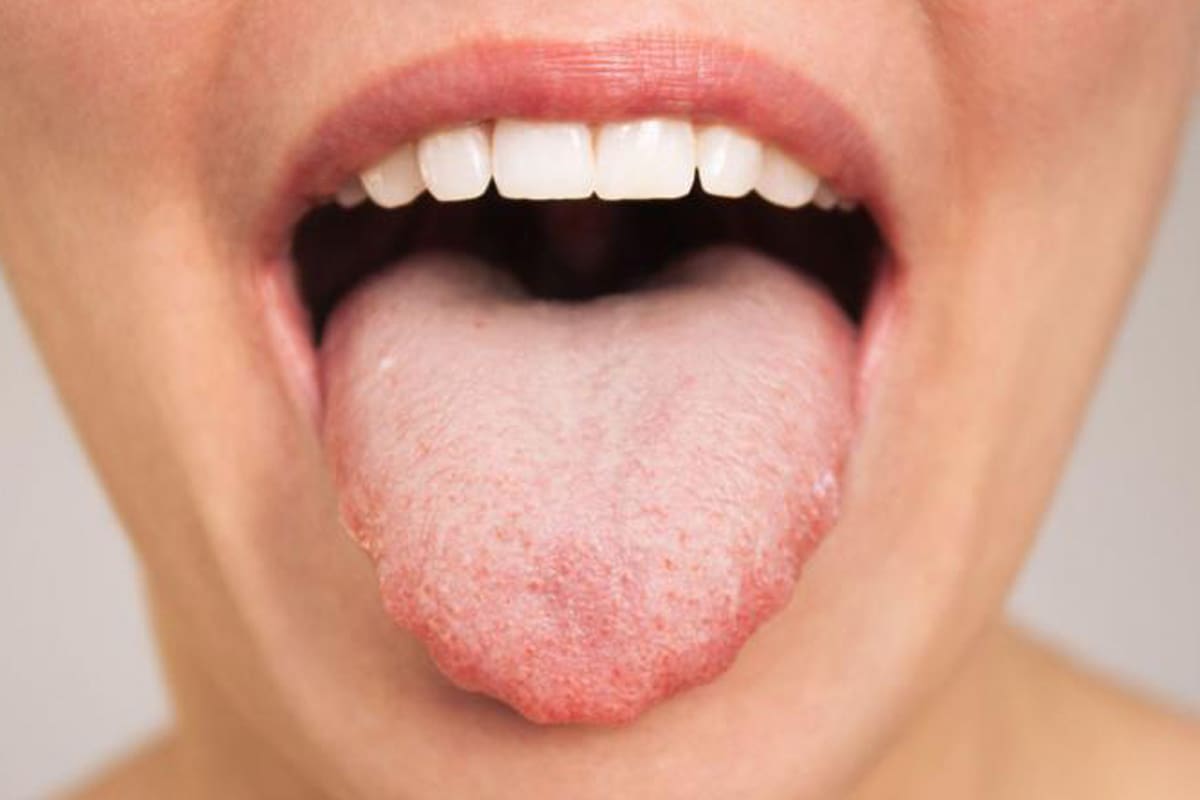 BBC; BBC MUndo; Brócoli; Sociedad; papilas gustativas.; lengua; boca; Sabor amargo; sabor dulce; amargor;