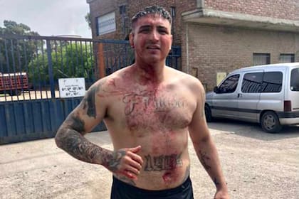 Brian Medina se mostró en su estado de WhatsApp con el rostro y el cuerpo cubierto de sangre