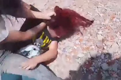 Brisa, una de las menores agredidas, terminó con fuertes lesiones