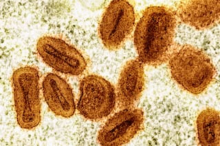 Brote de viruela símica en África ya no es una emergencia de salud global, dice OMS