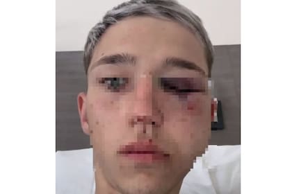 Brutal golpiza a un joven de 16 años que asistió a un cumpleaños