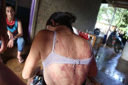 Brutal intento de femicidio en Misiones