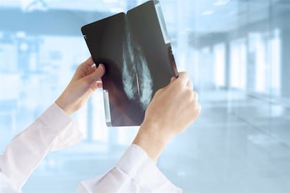 Buscan evitar la quimioterapia