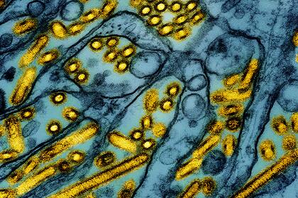 California declara emergencia por gripe aviar. ¿Cuán grave es la situación?