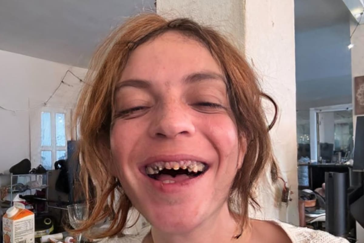 Camilo compartió fotos y videos donde es evidente el problema bucal que presenta