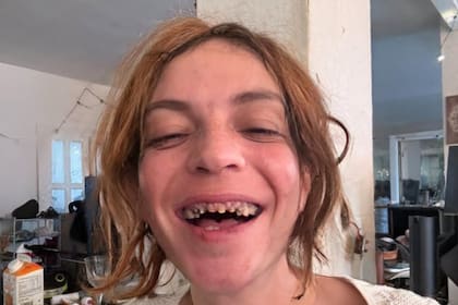 Camilo compartió fotos y videos donde es evidente el problema bucal que presenta