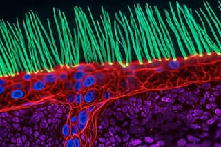 Los increíbles videos que revelan las maravillas microscópicas que tenemos dentro y a nuestro alrededor