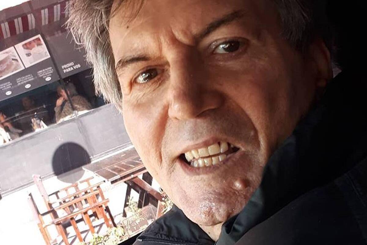Carlos Calvo, internado en un centro de cuidados intensivos