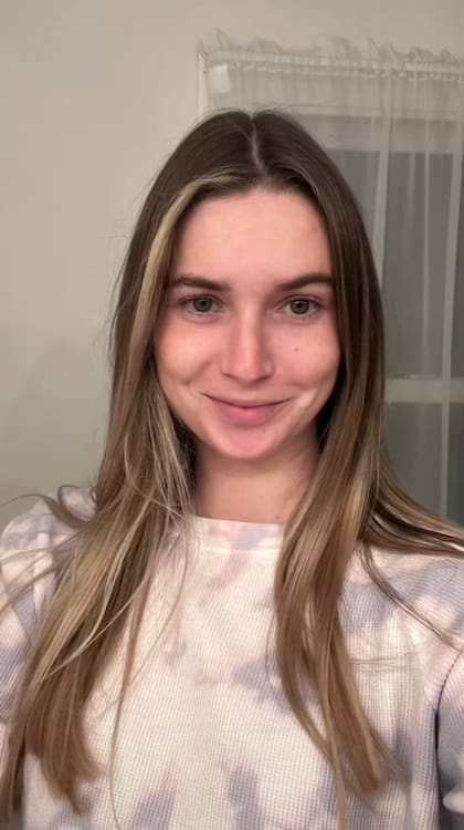 Caroline Cray es una joven de 25 años que sufre del Síndrome de Activación de Mastocitos