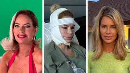 Caroline Stanbury describe su "estiramiento facial" como lo mejor que ha hecho