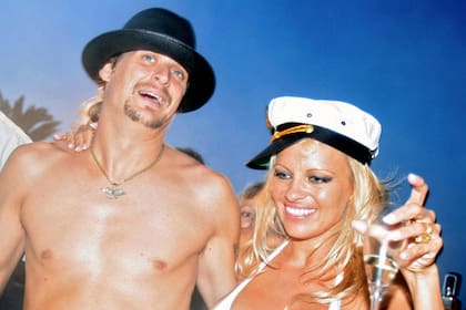 Casemonos en cualquier lado: por segunda vez Anderson se unió y se separó del cantante de Kid Rock