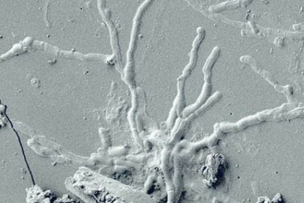 Casi 2000 años después, las células del sistema nervioso central de una de las personas que perecieron por la catástrofe volcánica permanecen intactas por el proceso de vitrificación que sufrieron