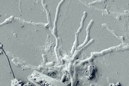Casi 2000 años después, las células del sistema nervioso central de una de las personas que perecieron por la catástrofe volcánica permanecen intactas por el proceso de vitrificación que sufrieron