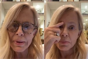 Cecilia Bolocco compartió con sus seguidores el mal momento de salud que atravesó (Foto: Captura / IG @ceciliabolocco)