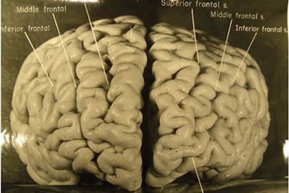 Cerebro