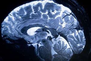 Cerebro; cerebro humano; ciencia; BBC, BBC mundo; Sociedad, Encéfalo; tronco encefálico; alzhéimer