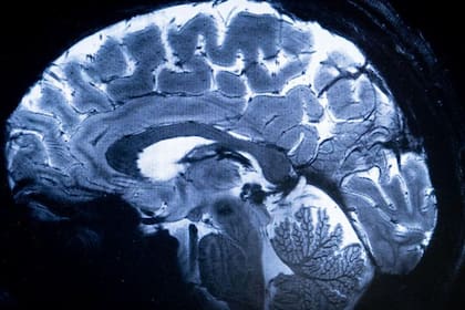 El encéfalo incluye el cerebro, el tronco encefálico y el cerebelo.
