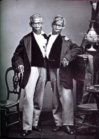 Chang y Eng Bunker, los primeros siameses documentados de la historia. (1811 - 1874)
