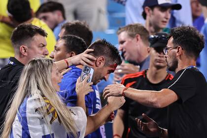 CHARLOTTE, NORTH CAROLINA - JULY 10: Fan of Uruguay bleeds after a fight during the CONMEBOL Copa America 2024 semifinal match between Uruguay and Colombia at Bank of America Stadium on July 10, 2024 in Charlotte, North Carolina. (Photo by Omar Vega/Getty Images)