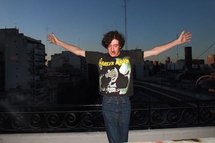 El bigote de Charly García es bicolor porque tiene vitíligo, un problema de pigmentación en la piel